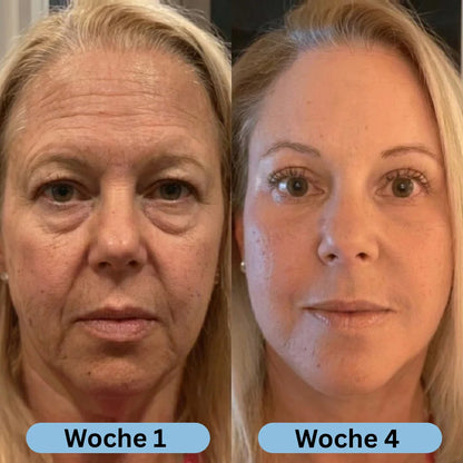 VoluFine | Koreanisches Kollagen-Serum mit Volufiline