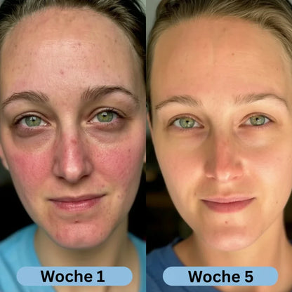 VoluFine | Koreanisches Kollagen-Serum mit Volufiline