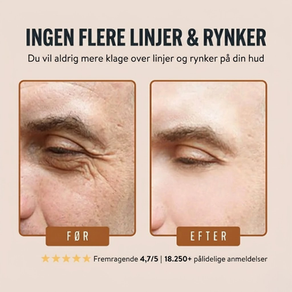 Forge Anti-Rynke Talgbalsam