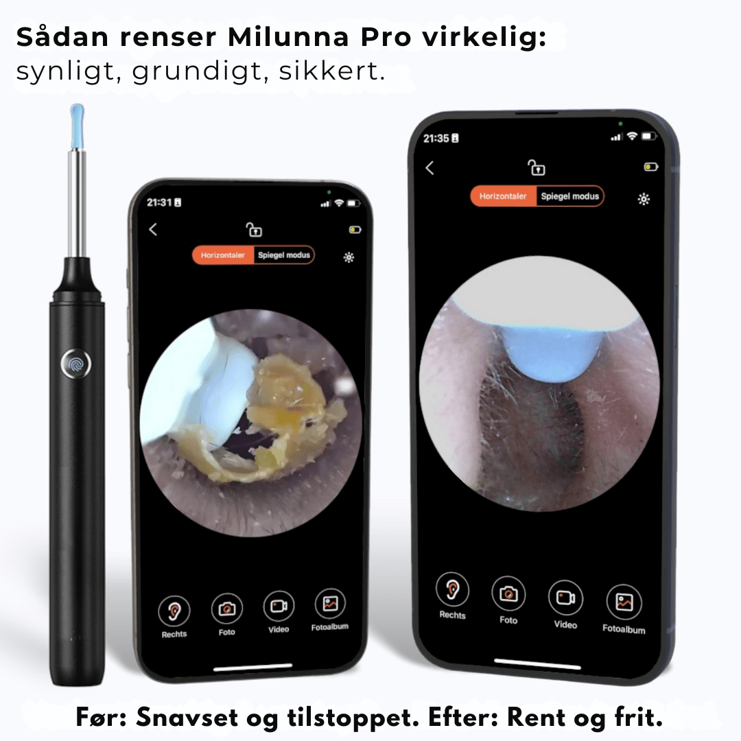 Milunna Pro