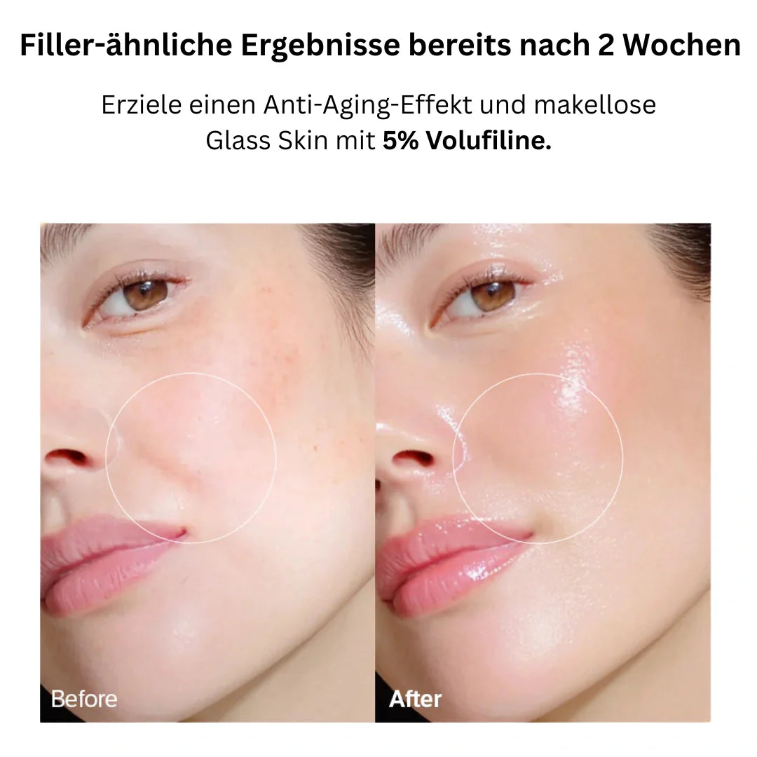 VoluFine | Koreanisches Kollagen-Serum mit Volufiline