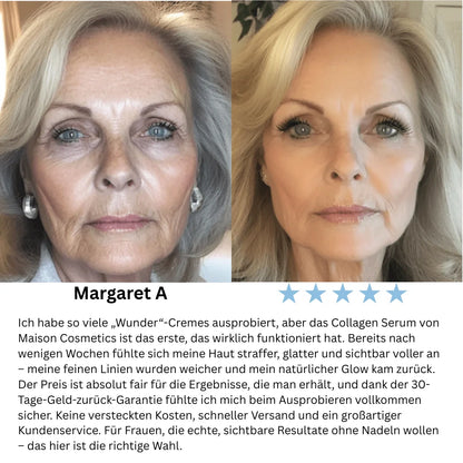 VoluFine | Koreanisches Kollagen-Serum mit Volufiline