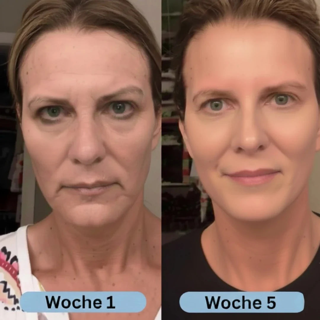 VoluFine | Koreanisches Kollagen-Serum mit Volufiline