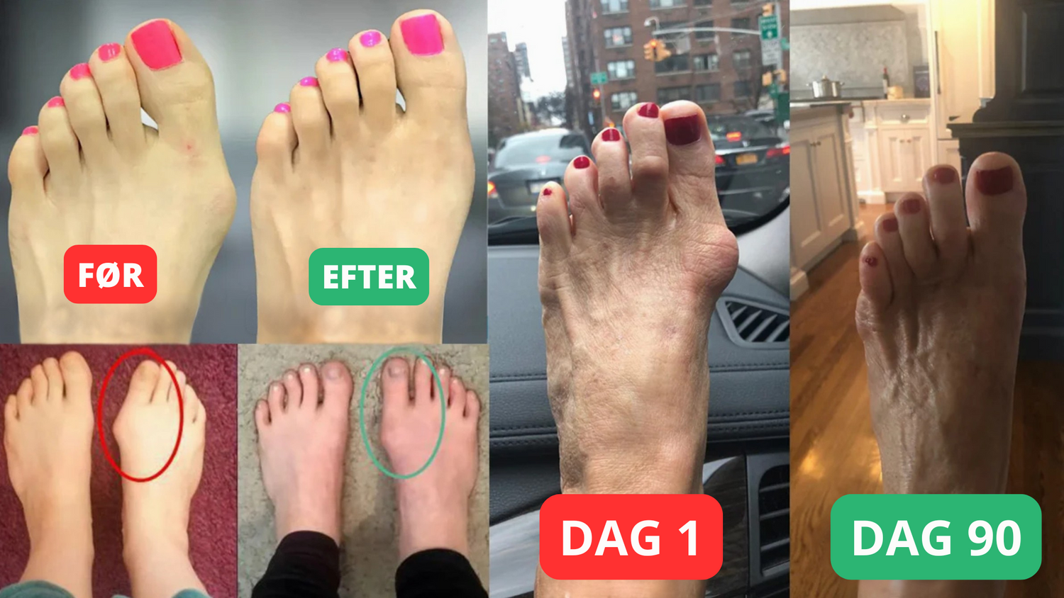 VORHER NACHHER.png__PID:c76c3bda-3d58-4c2a-86b4-18f89dc9c753